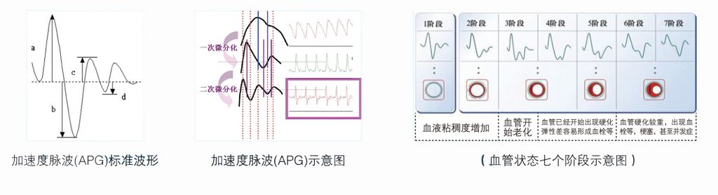 精神压力分析仪