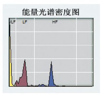 心率变异分析仪