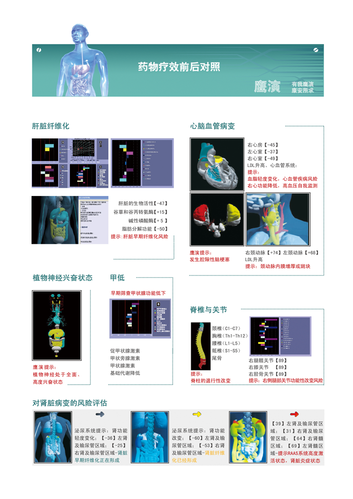 糖尿病早期无创检测仪