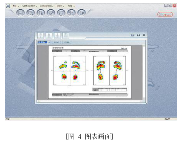 足底压力分析仪