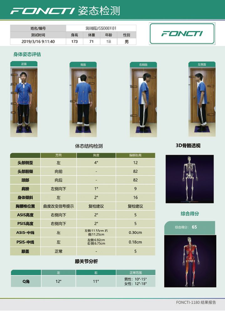 步态分析系统产品报告