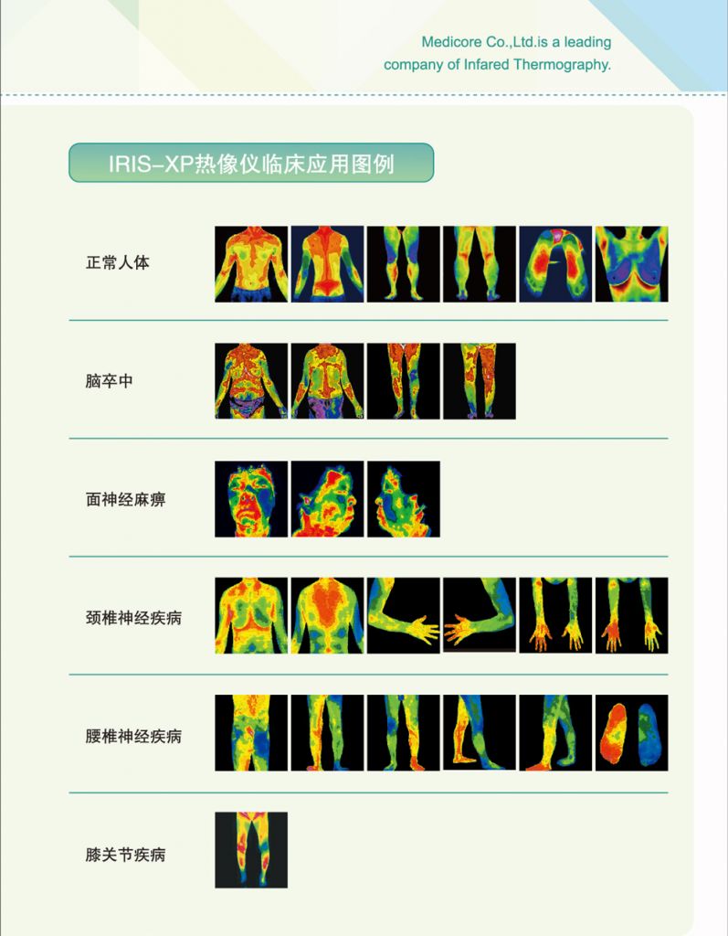 红外热像仪