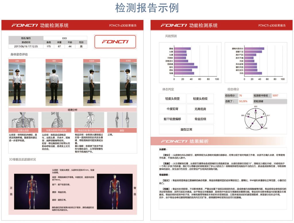 体态评估