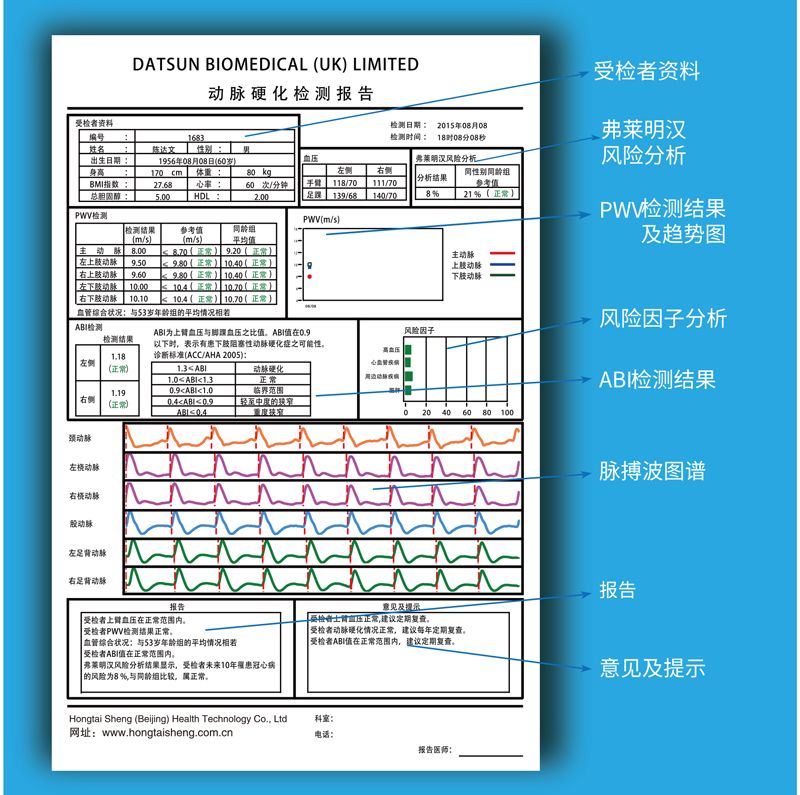 脉搏波速测定仪