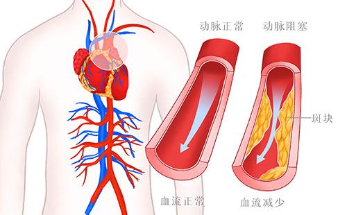 动脉硬化检测仪