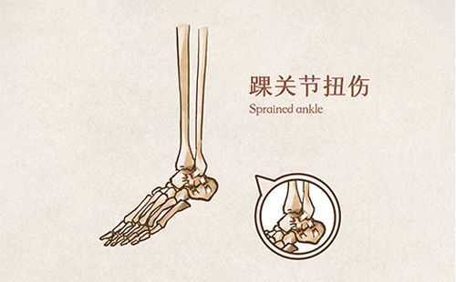 定制鞋垫