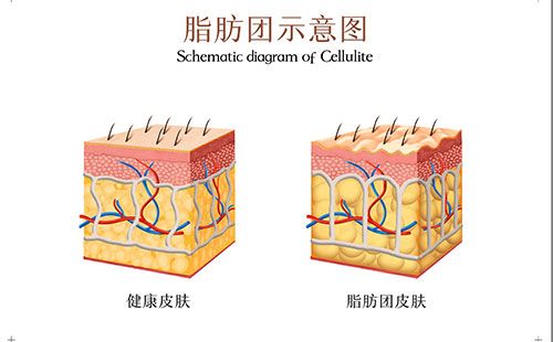 人体成分分析仪