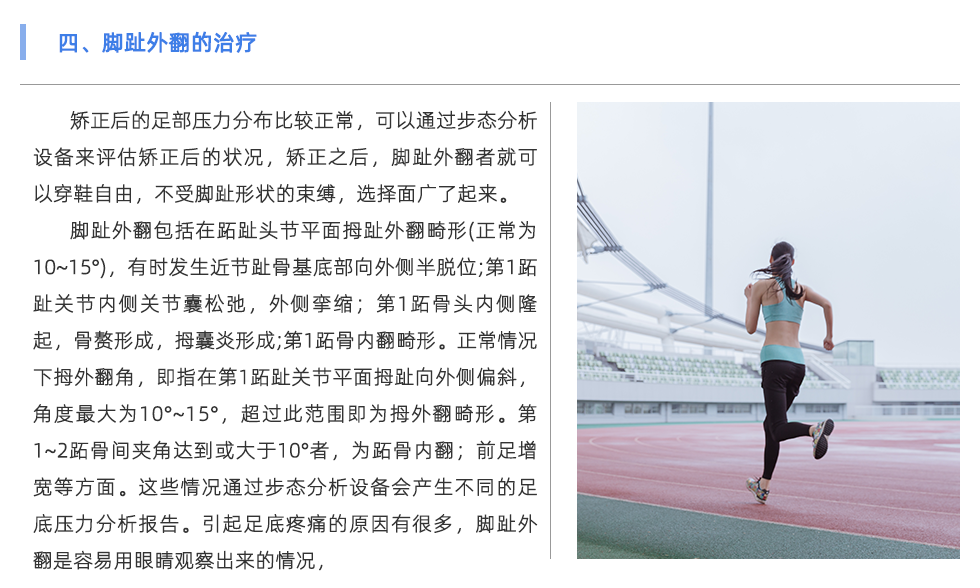 步态分析设备