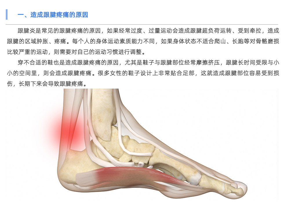 定制鞋垫