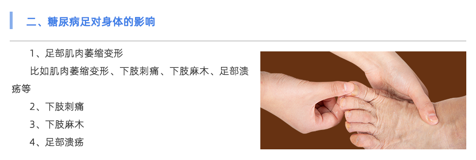 足底压力分析仪