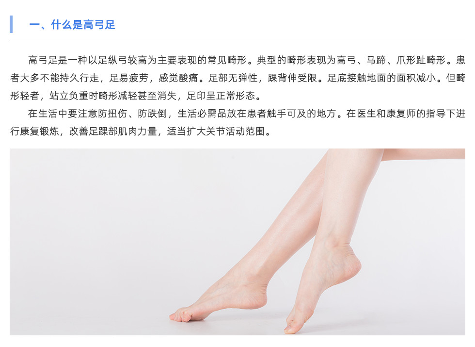 步态分析设备