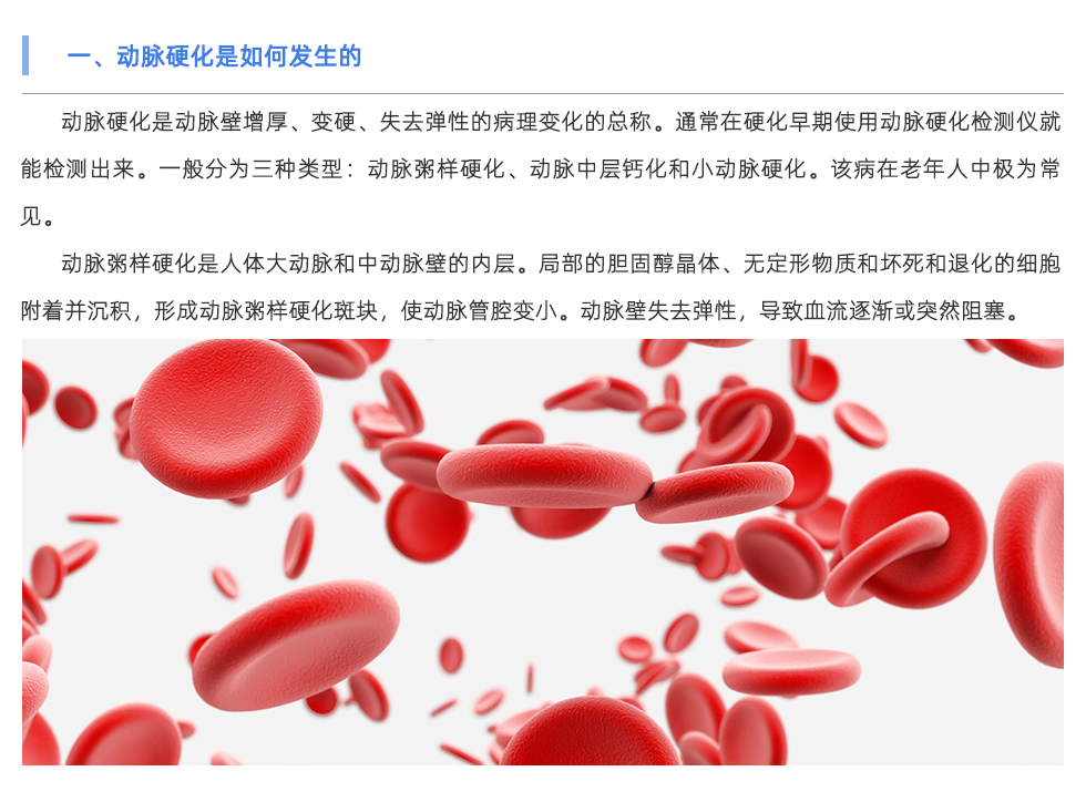 动脉硬化检测仪