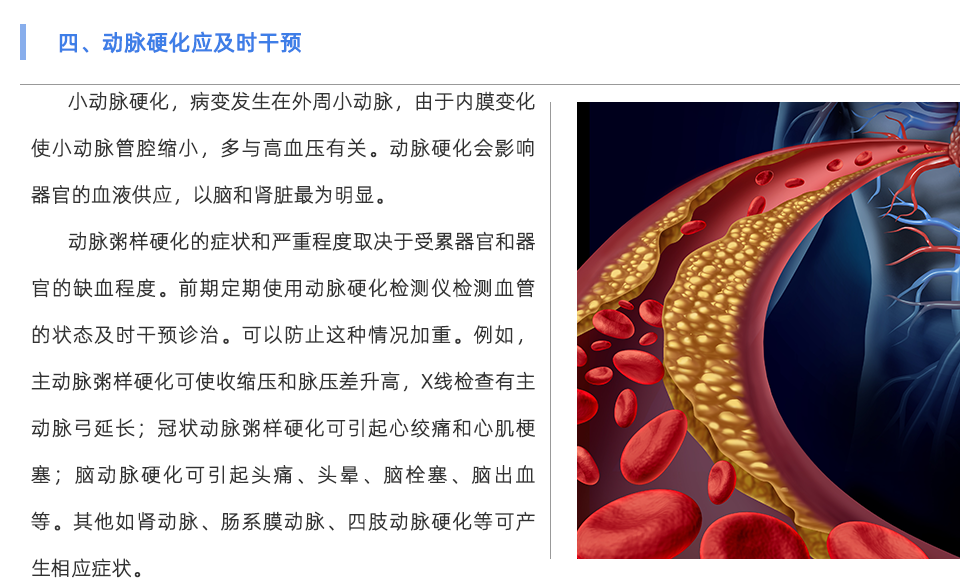 动脉硬化检测仪