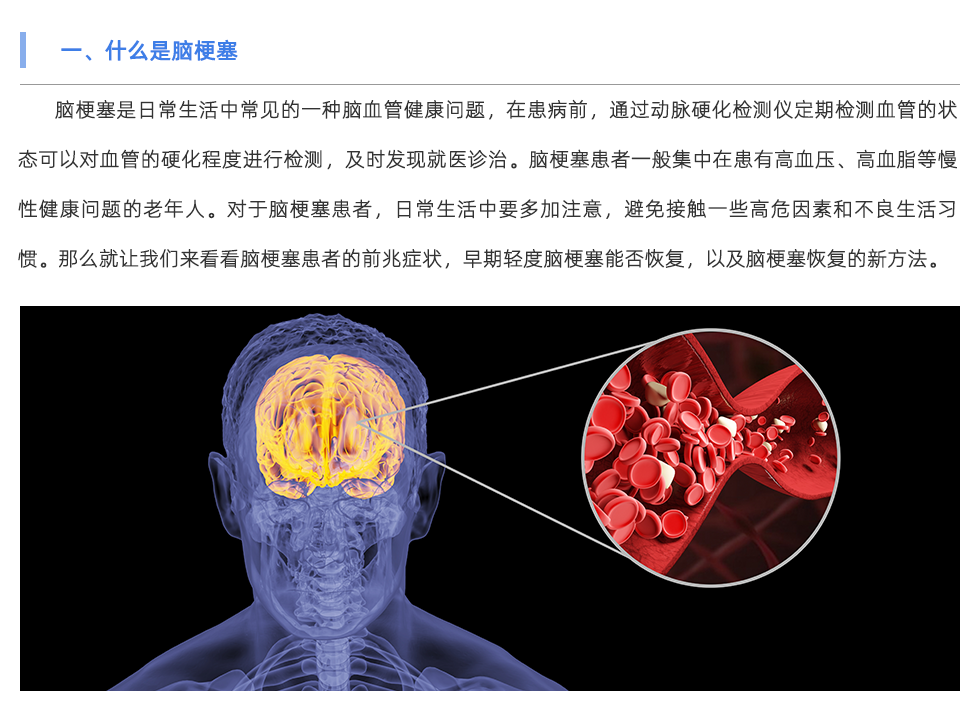 动脉硬化检测仪