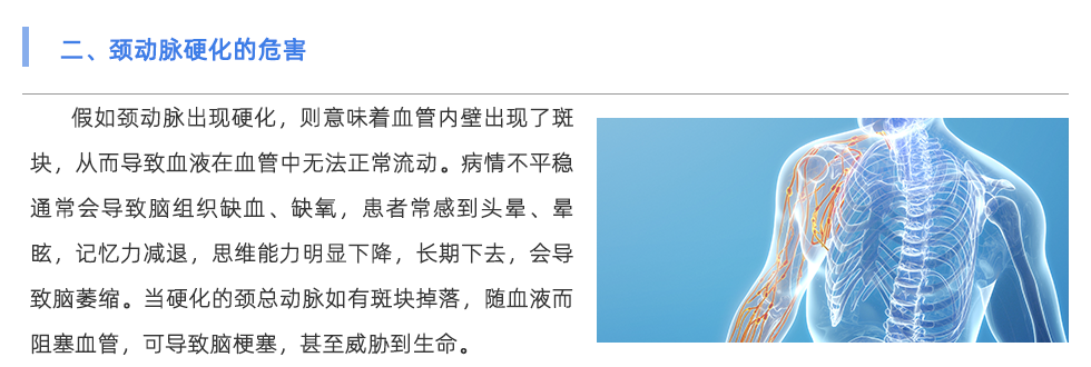 动脉硬化检测仪