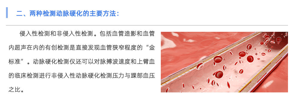 动脉硬化检测仪