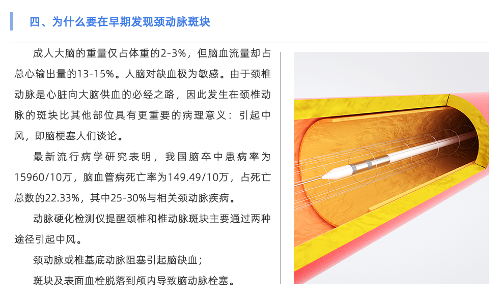动脉硬化检测仪