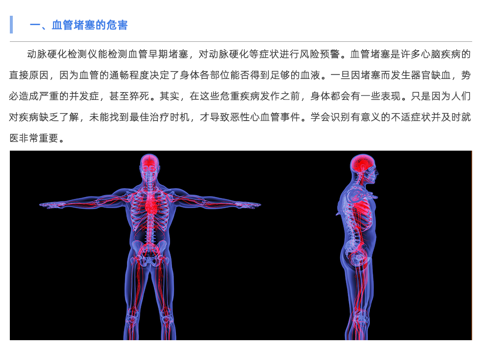 动脉硬化检测仪