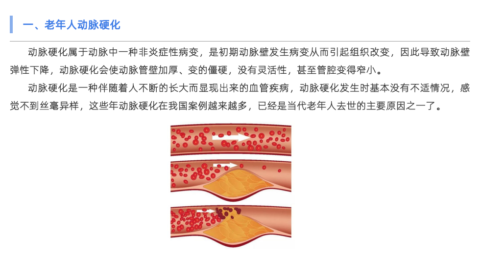 使用动脉硬化检测仪