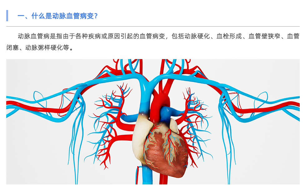 动脉硬化检测仪