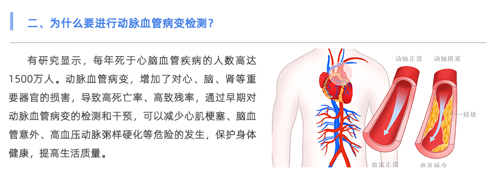 动脉硬化检测仪
