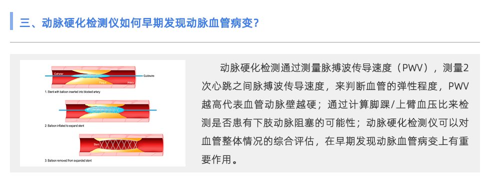 动脉硬化检测仪