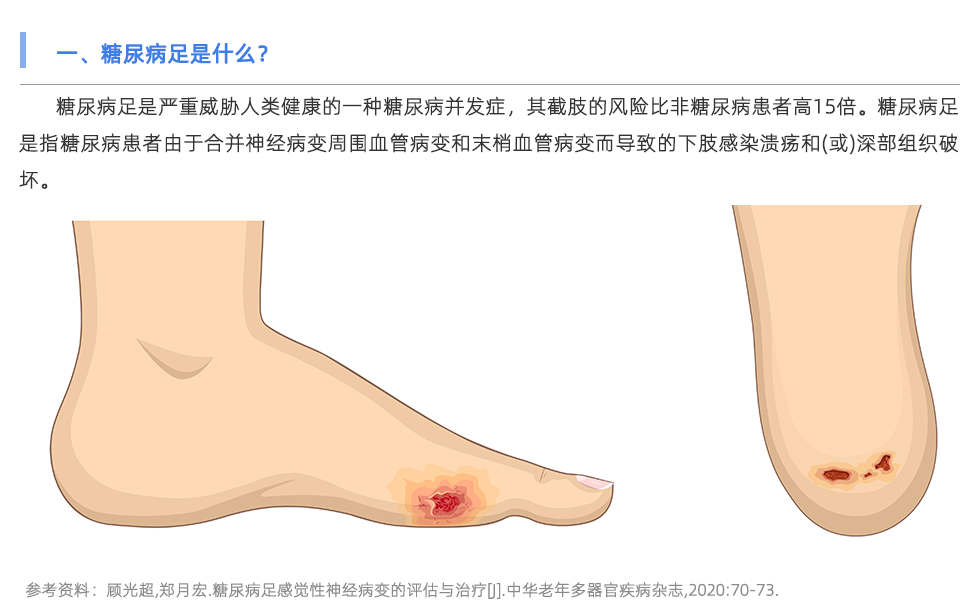 定制鞋垫