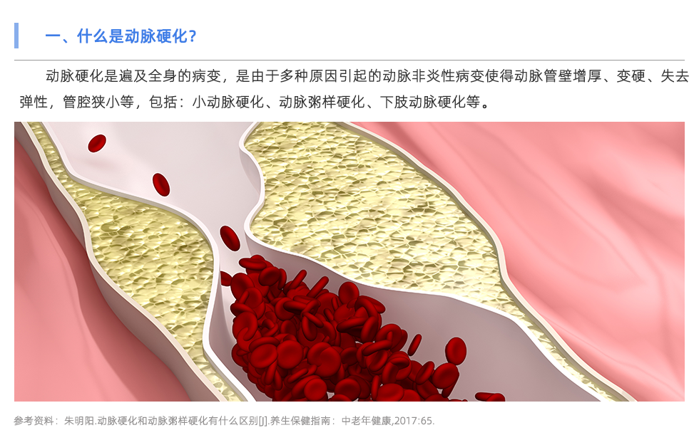 动脉硬化检测仪