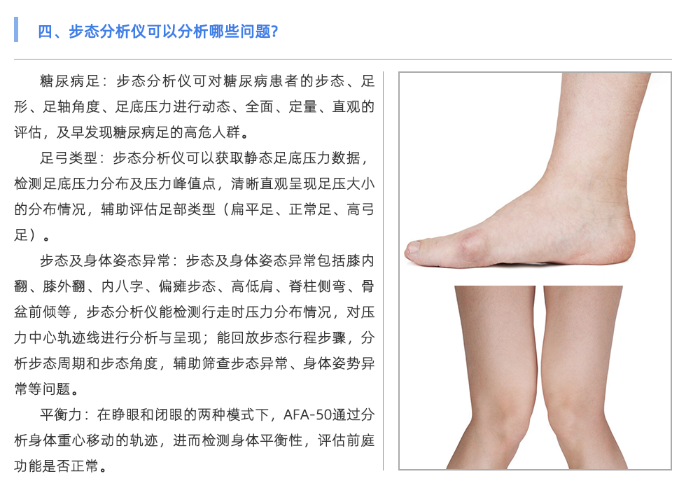 步态分析仪