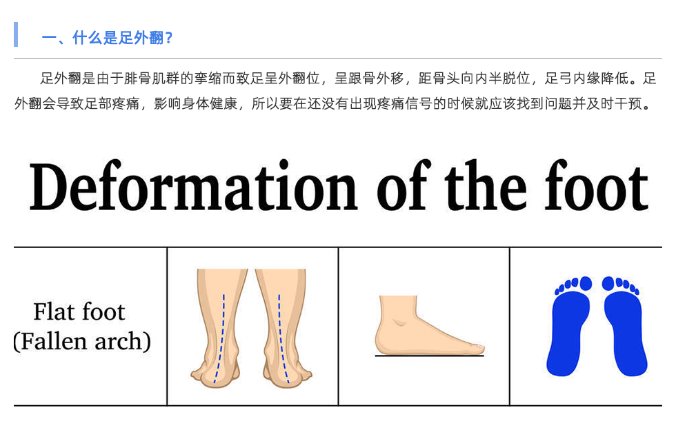 定制鞋垫