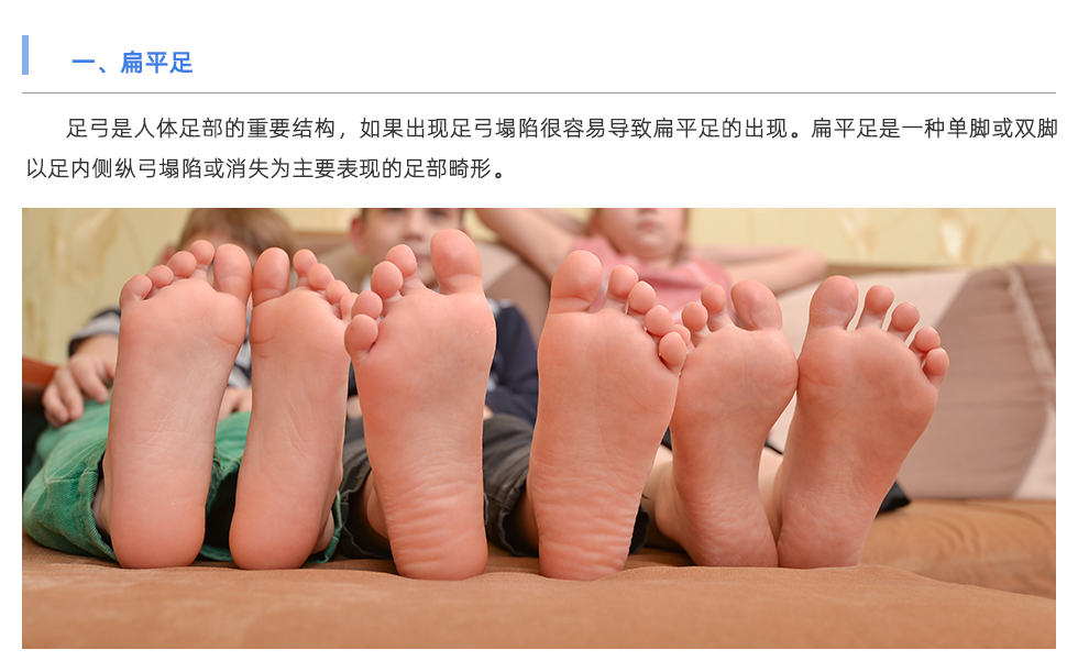 步态分析仪