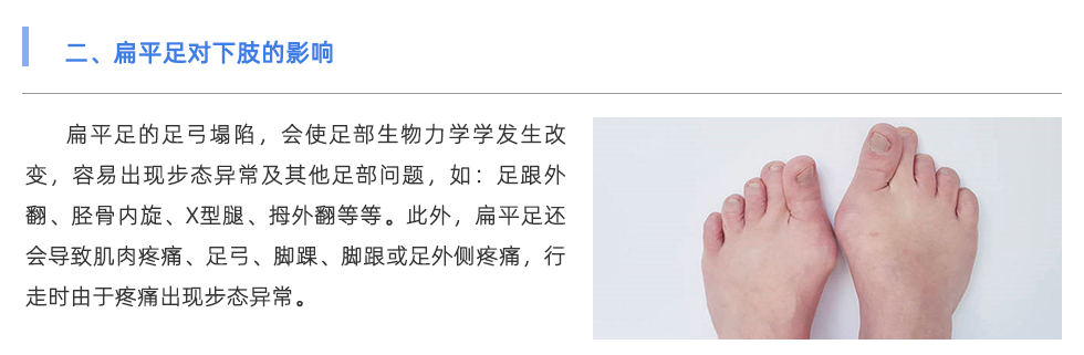步态分析仪