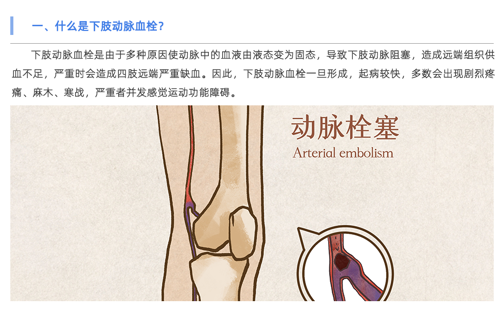 动脉硬化检测仪