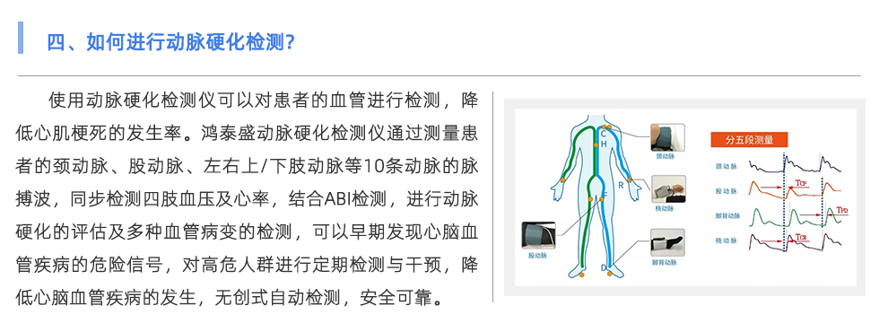 动脉硬化检测仪