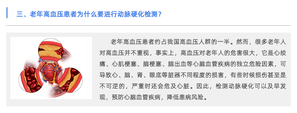 动脉硬化检测仪