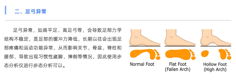 步态分析仪