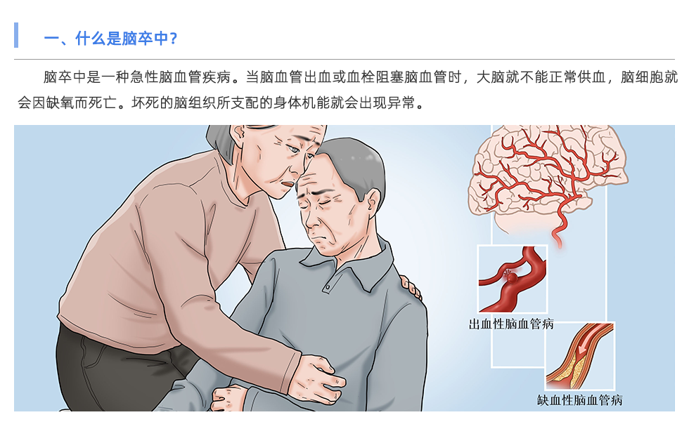 动脉硬化检测仪