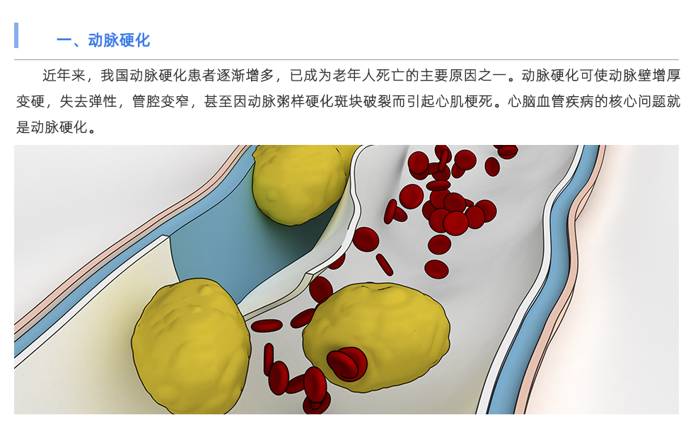 动脉硬化检测仪