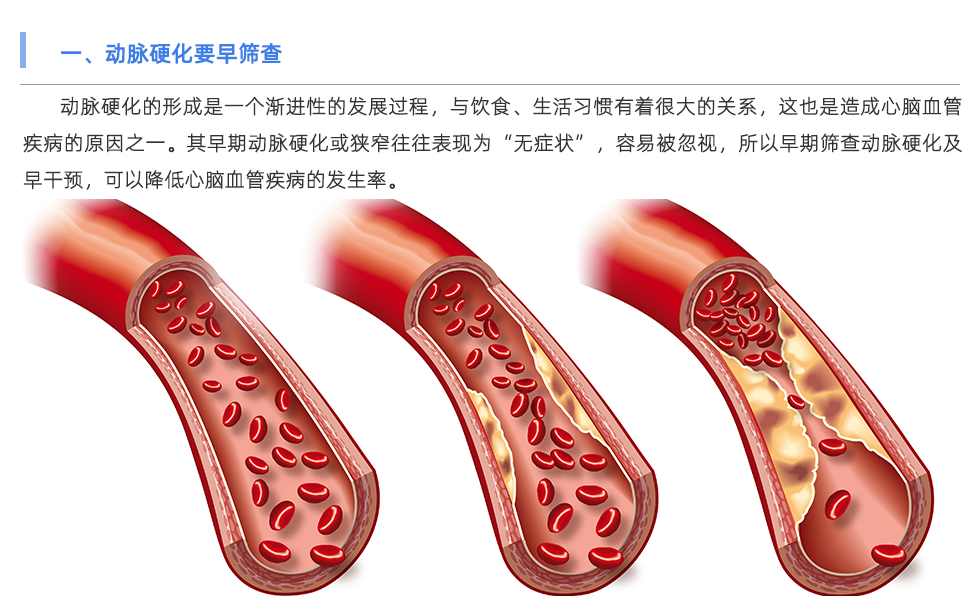 动脉硬化检测仪