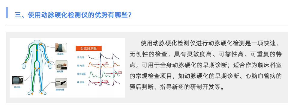 动脉硬化检测仪