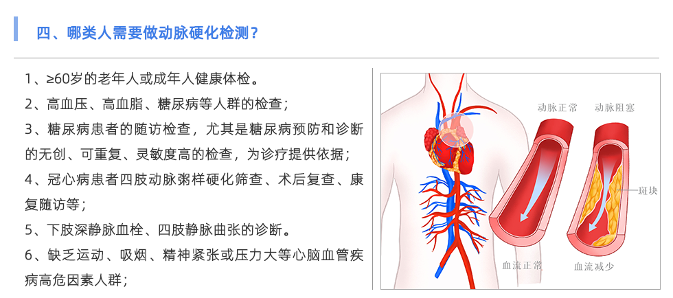 动脉硬化检测仪