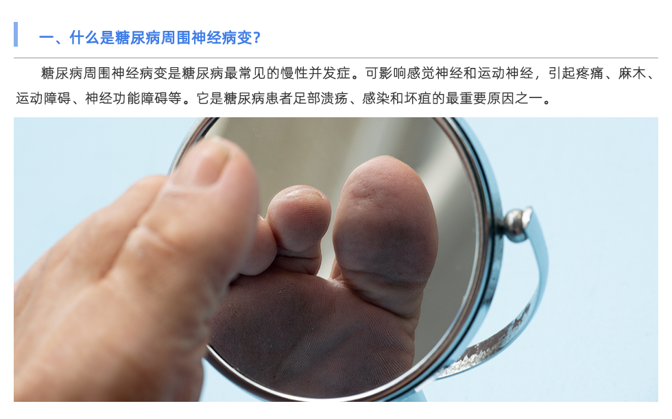 步态分析仪