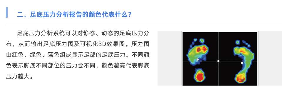 足底压力分析系统
