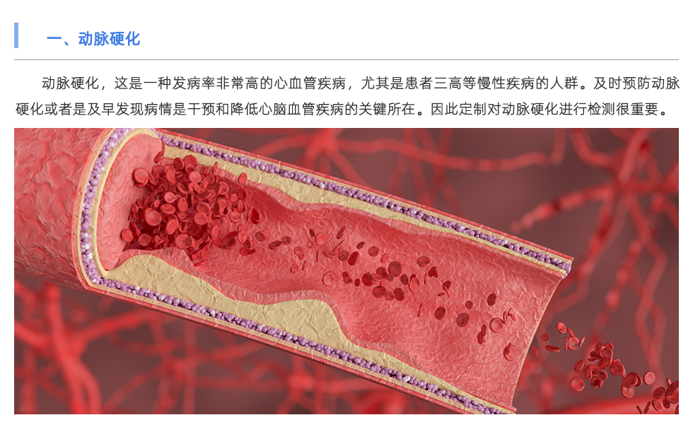 动脉硬化检测仪