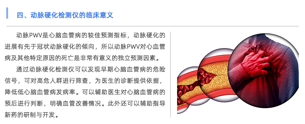 动脉硬化检测仪