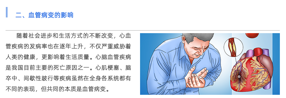动脉硬化检测仪