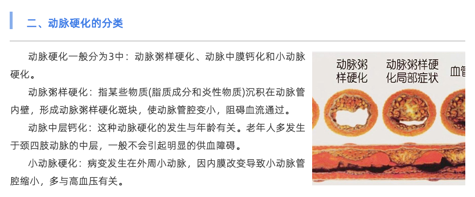 动脉硬化检测仪