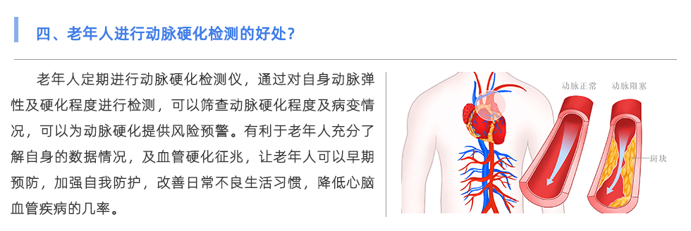 动脉硬化检测仪