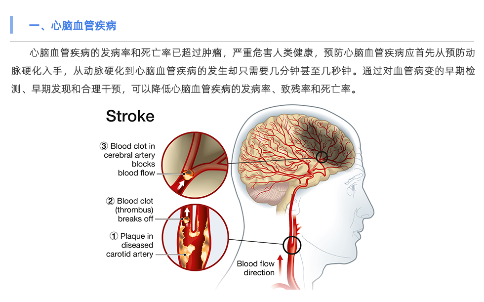 动脉硬化检测仪