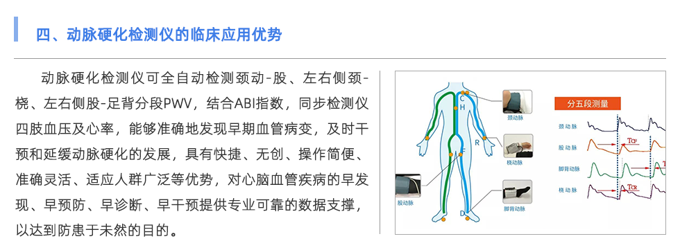 动脉硬化检测仪